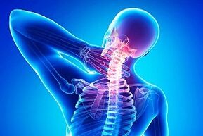 rugpijn als symptoom van osteochondrose