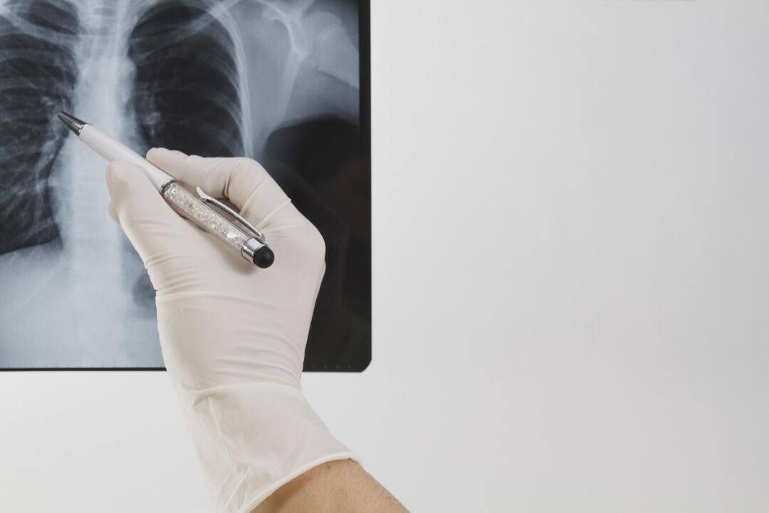 Röntgenfoto voor het diagnosticeren van osteochondrose