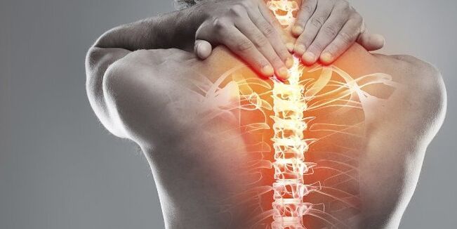 Medische opties voor cervicale therapie van cervicale osteochondrose