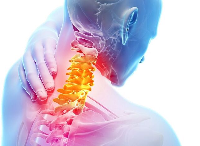 Symptomen en fasen van de ontwikkeling van cervicale osteochondrose