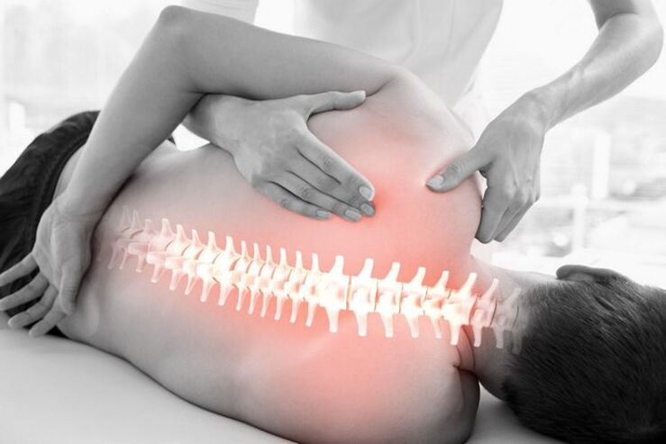 Manuele therapiesessie voor osteochondrose van de thoracale wervelkolom